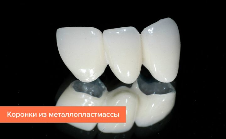 Коронки из металлопластмассы