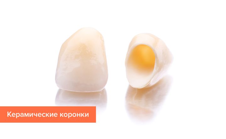 Коронки из керамики