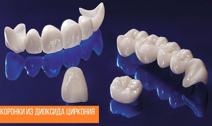 Коронки из диоксида циркония